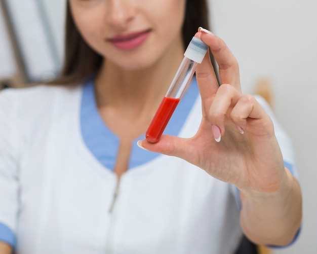 Дополнительные анализы крови для определения причины анемии