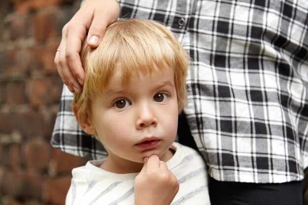 Причины и симптомы себорейного дерматита на голове у ребенка