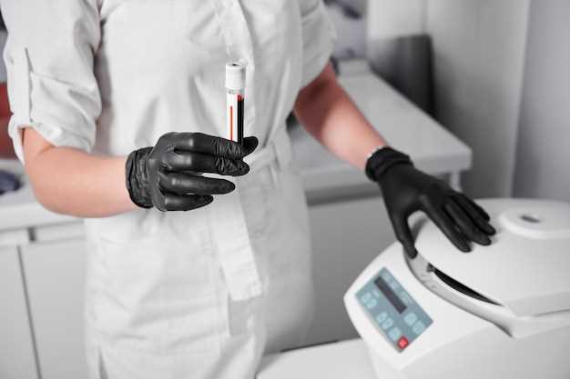 Как проводится анализ крови для определения сепсиса?