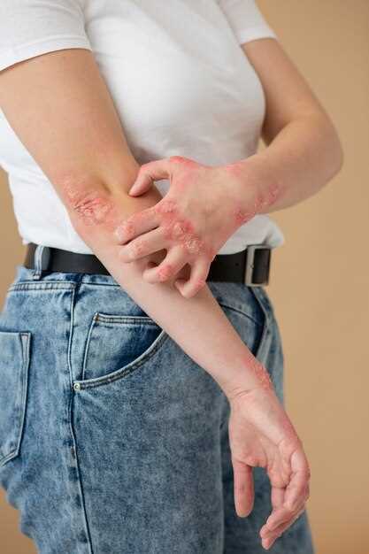Симптомы аллергии и атопического дерматита: что следует обратить внимание?