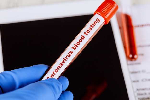 Частота проведения анализа на стерильность крови