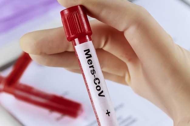 Как повысить уровень тромбоцитов в крови у женщин