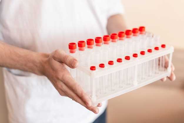 Как получают кровь на ХГЧ для определения беременности