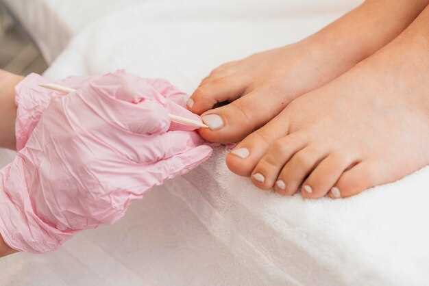 Чернеют ногти на ногах у женщин: основные причины
